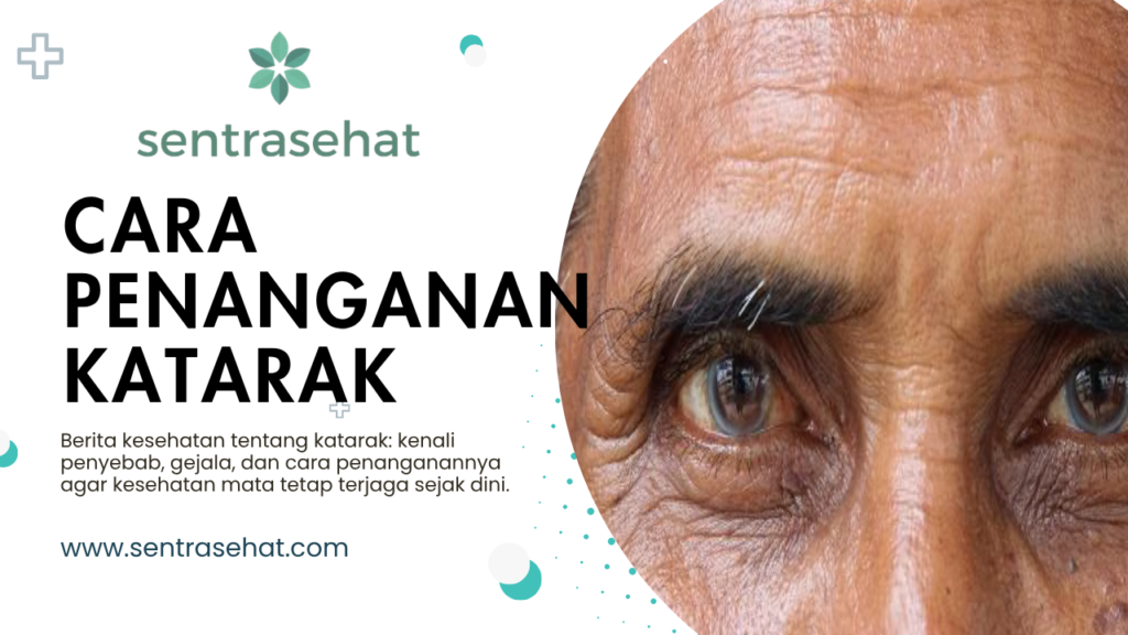 Berita kesehatan tentang katarak: kenali penyebab, gejala, dan cara penanganannya agar kesehatan mata tetap terjaga sejak dini.