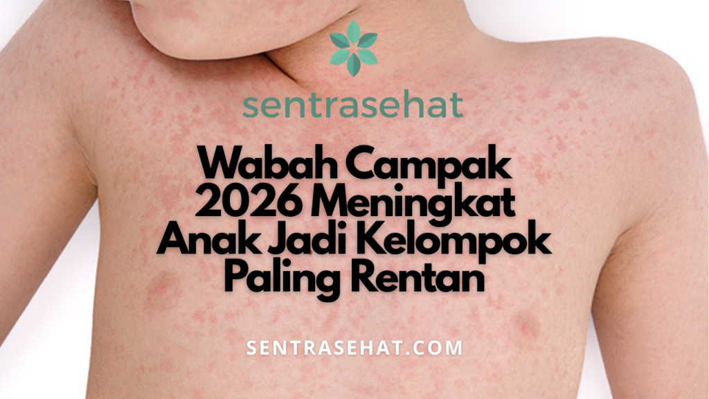 Wabah Campak 2026 Meningkat - Anak Jadi Kelompok Paling Rentan