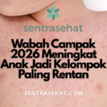 Wabah Campak 2026 Meningkat - Anak Jadi Kelompok Paling Rentan